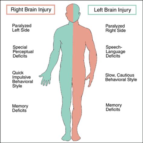 Cerebral Vascular Accident CVA Stroke Flashcards Quizlet