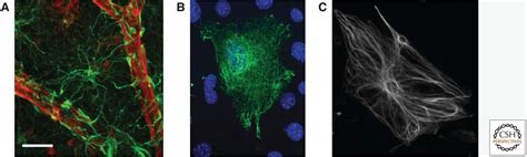 Type Iii Intermediate Filaments Desmin Glial Fibrillary Acidic Protein