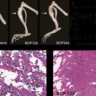 BCP Induced Mechanical Allodynia Of Hindpaw A Three Dimensional