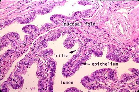 Fallopian Tube Histology Labeled