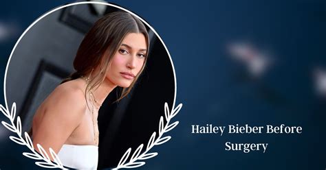 Hailey Bieber Photos Before And After Of Her Plastic Surgery Venture Jolt