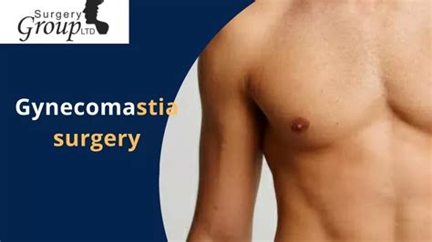 Ppt Gynecomastia Surgery Group Powerpoint Presentation Free