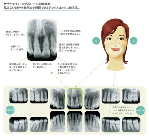 診療案内｜yamazaki Dental Clinic