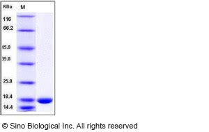 Recombinant Human Il Gamma Il F Protein Hnae Sino Biological