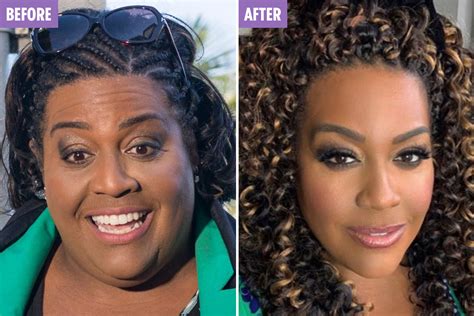 Alison Hammond Weight Loss 2024 - Denys Marlena