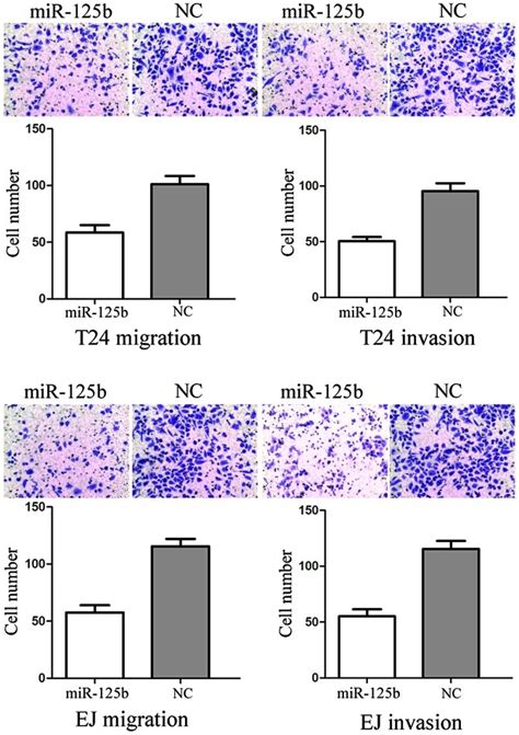 Mir B Inhibition Of Cell Migration And Invasion Representative