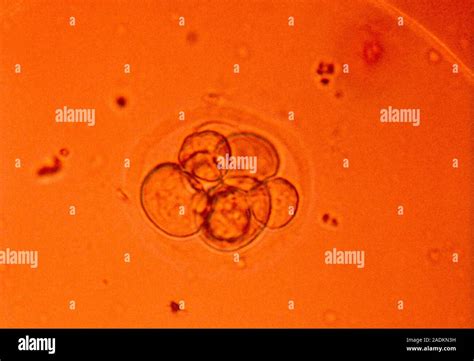 Light Micrograph Of A Human Zygote The Primitive Embryo At The Eight