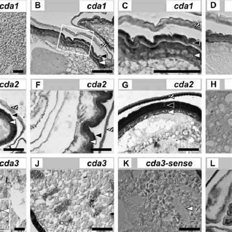 In Situ Hybridization Analysis Of Cell Type And Tissues Expressing