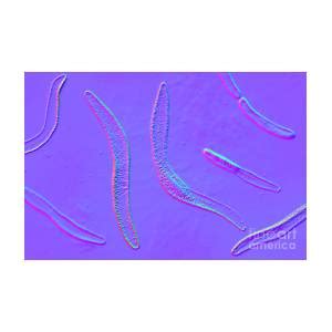 Fusobacterium Photograph By Kateryna Kon Science Photo Library Fine