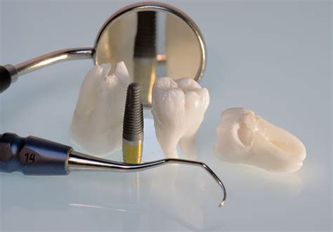 How Do They Remove Canine Teeth In Humans? (Reasons & Removal Procedures)