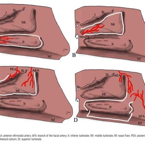 Harvesting Of Lateral Nasal Wall Flaps Posterior Pedicle Inferior Download Scientific Diagram