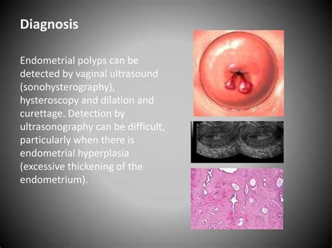 Benign Diseases Of The Uterus And Cervix