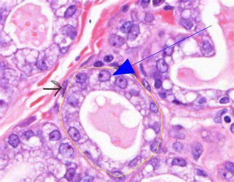 Mammary Gland Diagram Quizlet