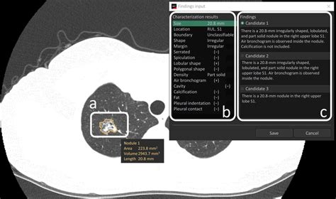 Radiologists With And Without Deep Learningbased Computer Aided Diagnosis Ai Blog Esr