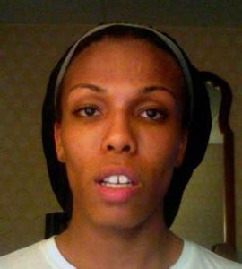 Dr Chettawut Sex Reassignment And Facial Feminization Surgery Center Facial Feminization