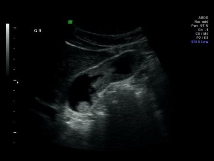 Radiology Quiz Radiopaedia Org Playlist Abdomen Gb