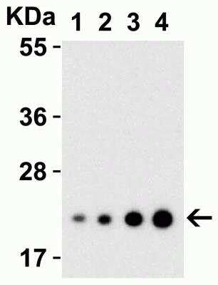 IL 23A IL 23 P19 Antibody BSA Free NBP1 76697 By Novus Part Of Bio