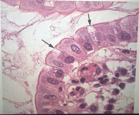 Solved What Type Of Cell Is Indicated By The Arrow Chegg