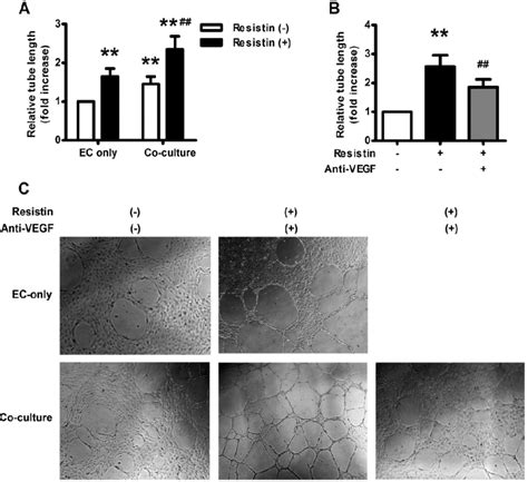 HO 8910 Cells Derived VEGF Mediated Resistin Induced Angiogenesis Of