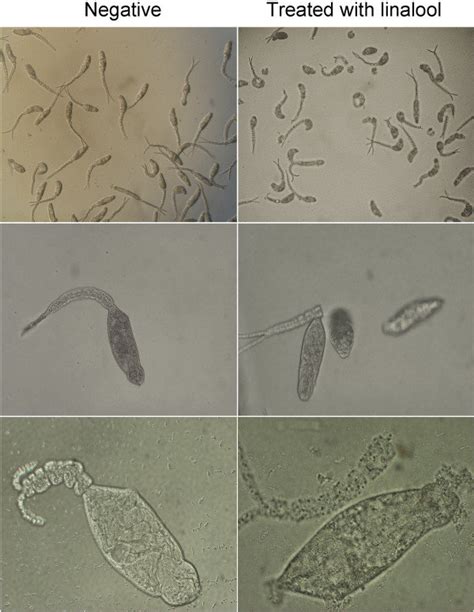 Morphological Changes Of Cercariae With Exposure To Linalool Were