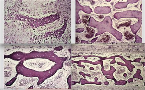 Diagram of Intramembranous Ossification | Quizlet