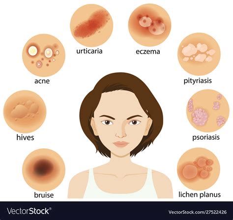 Common Skin Conditions Chart