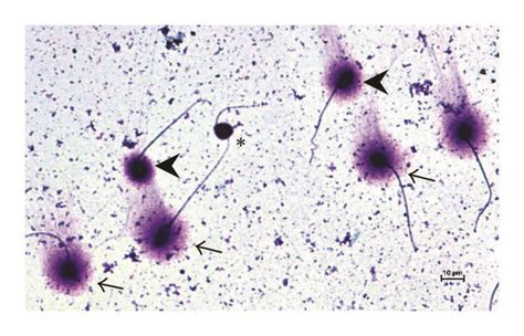 Representative Microphotography Of The Sperm Chromatin Dispersion