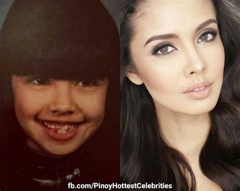 21 Before And After Photos Of Filipino Celebrities