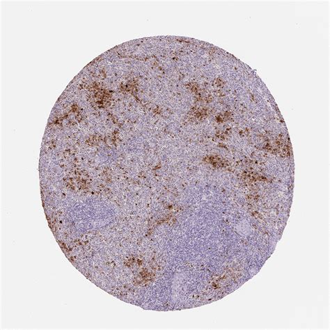 Tissue Expression Of Defa Staining In Spleen The Human Protein Atlas