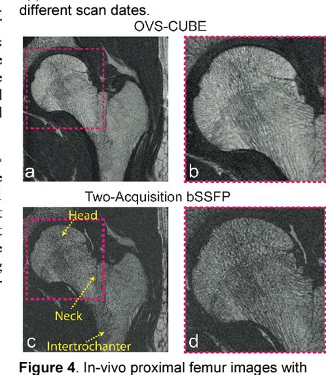 Figure From High Resolution D Fast Spin Echo Mri Combining Variable