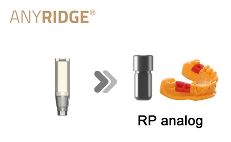 Anyridge Rp D Print Model Megagen Digital