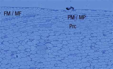 Primary Meristematic Pm Fundamental Meristem Fm And Procambium