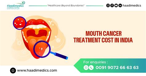 Mouth Cancer Treatment Cost In India