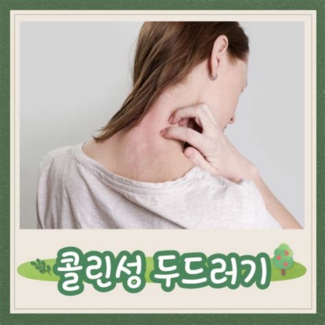 콜린성 두드러기 원인 치료법 운동할때 가려운 이유 네이버 블로그