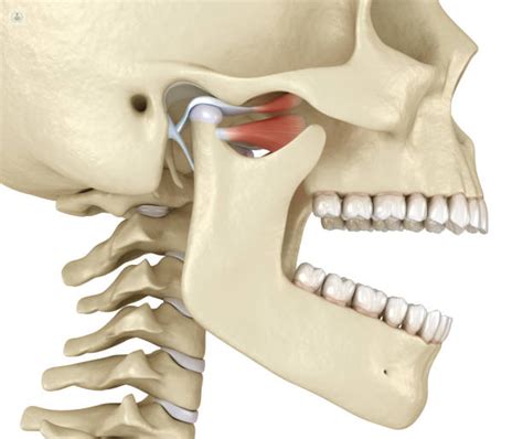 Articulaci N De La Mand Bula Atm Qu Es S Ntomas Y Tratamiento