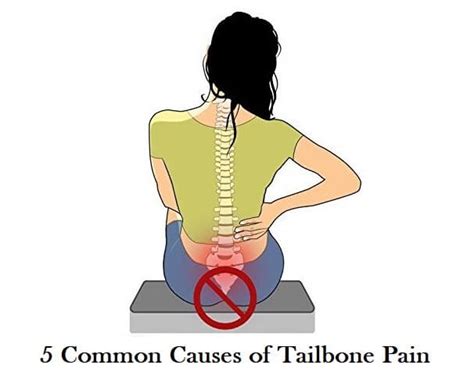 5 Common Causes of Tailbone Pain - Inspiring MeMe