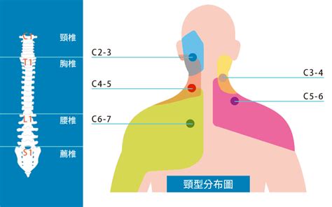 手麻千萬別輕忽！小心頸椎壓迫神經？認識頸椎壓迫的症狀及舒緩方式（上）