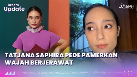 Tatjana Saphira Pede Pamerkan Wajah Berjerawat Youtube