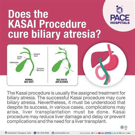 kasai procedure  hyderabad surgery indications  benefits