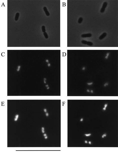 Localization Of HU GFP Fusion Protein In Escherichia Coli LMC500 Cells