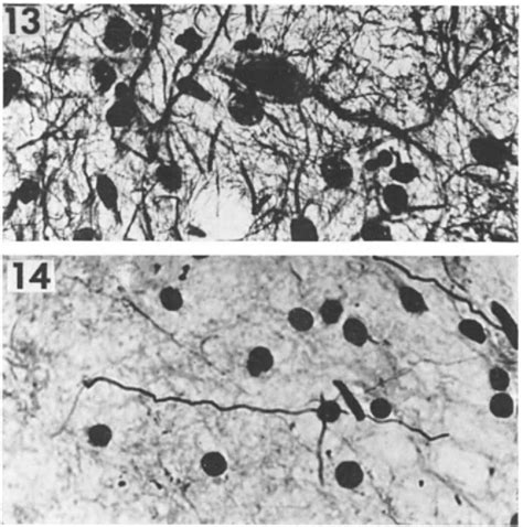 Figure 13 from LVI The Histology of the Human Olfactory Bulb and the Extracerebral Part of the ...