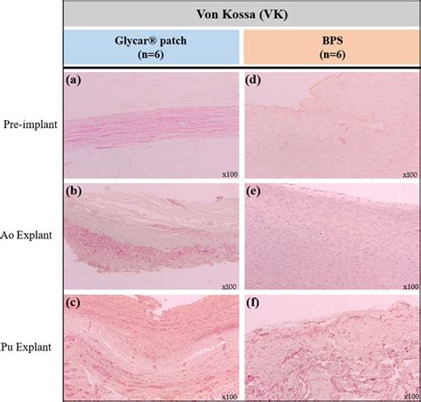 Representative Von Kossa Vk Histological Stain Of The Pre Implanted Download Scientific