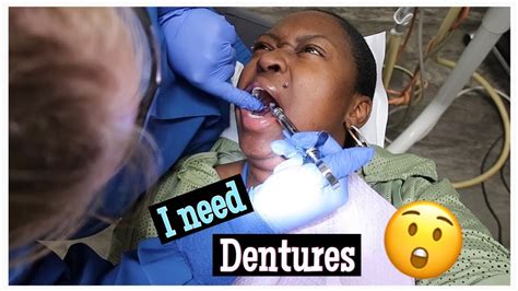 Tooth Extraction Getting My Teeth Pulled Youtube