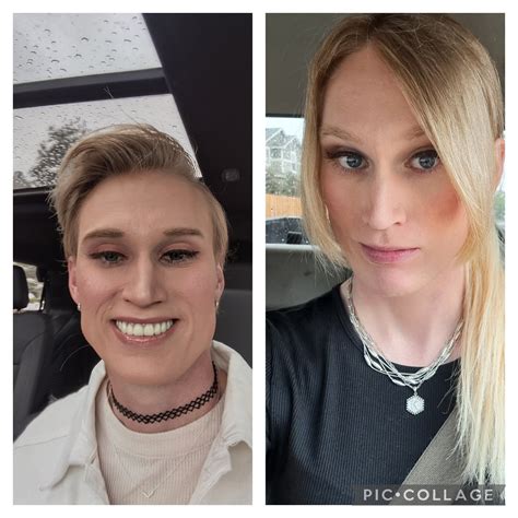 Left 12 Months Ago Right 14 Months Hrt I Think It S Working 😊 R Transtimelines