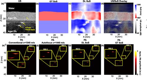 Figure 3 From Learning Based Sound Speed Reconstruction And Aberration