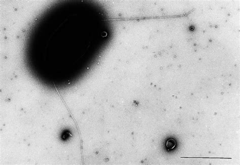 Electron Micrograph Of E Coli Orn172 Pms1000 Bar 1 ␮ M Final