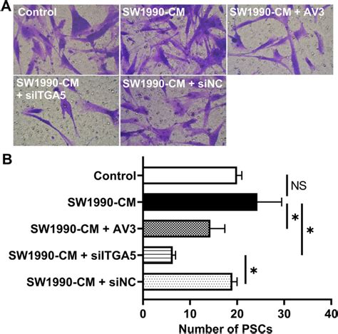 Itga5 Inhibition In Pancreatic Stellate Cells Re Educates The In Vitro