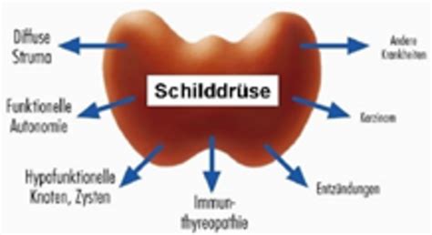 Schilddrüse Slk Kliniken