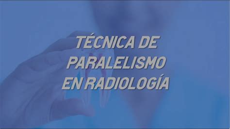 Radiolog A Dental T Cnica De Paralelismo Youtube