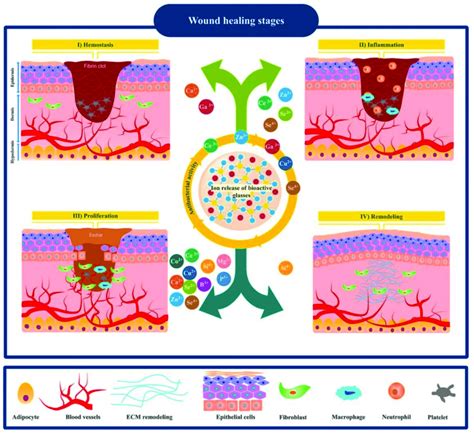 Schematic Illustration Showing Four Overlapping Stages Of The Wound